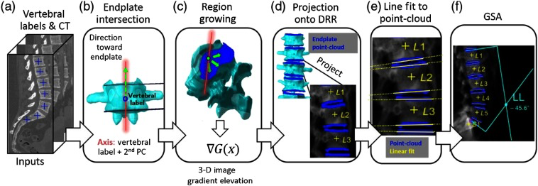 Automatic global spinal alignment image analysis pipeline from vertebral labels and CT